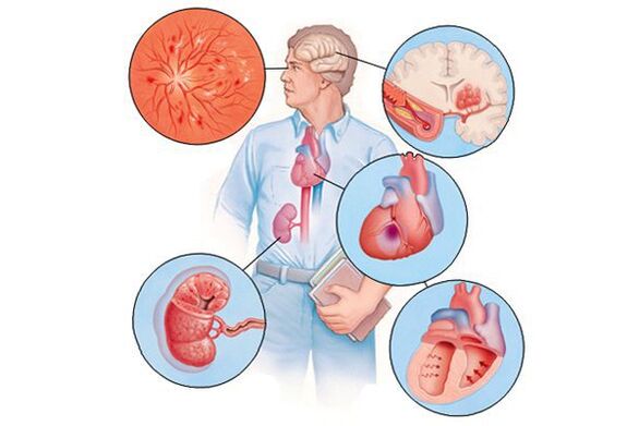 Hipertentsio arterial luzea duten hainbat organoetan kalteak